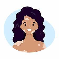 Fivfivgo™ BeeVenom Vitiligo ( 7 Days Result ) Treatment Cream- BUY 1 GET 1 FREE ⭐️⭐️⭐️⭐️ 4.9/5 Reviews