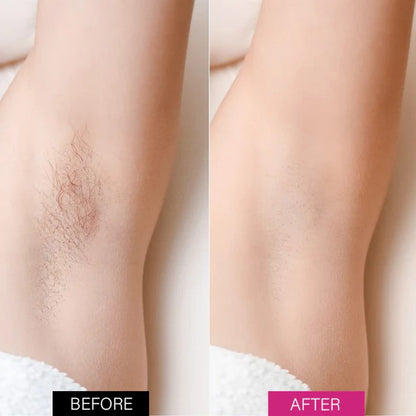 Fivfivgo™ BeeSilk Hair Removal Mousse-BUY 1 GET 1 FREE ⭐️⭐️⭐️⭐️ 4.9/5 Reviews