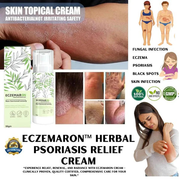 Eczemaron Anti Fungal Cream 50gm | Buy 1 Get 1 Free | ⭐️⭐️⭐️⭐️ 4.9/5 Reviews
