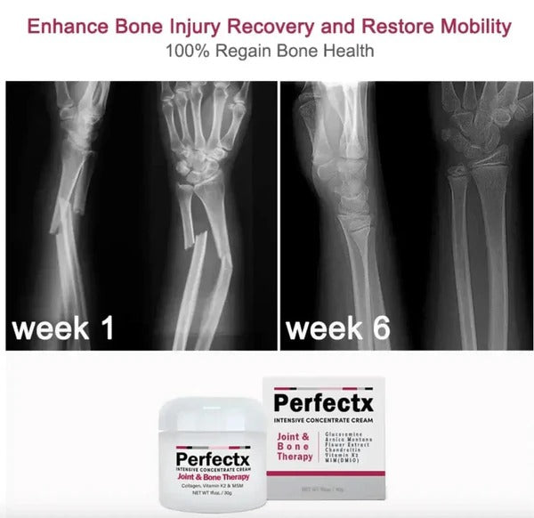 Perfectx Joint And Bone Therapy Cream Intensive Concentrate Cream Natural Joint & Bone Therapy Cream (50 g)BUY 1 GET 1 FREE ⭐️⭐️⭐️⭐️ 4.9/5 Reviews