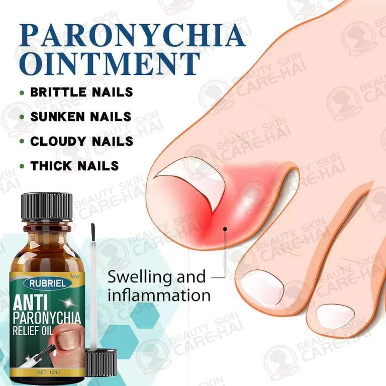 Anti Paronychia Relief Oil ( BUY 1 GET 1 FREE )