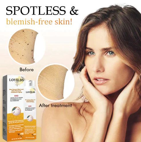 WartX™ Bee Venom Tags & Wart Treatment Spray | Buy 1 Get 1 Free