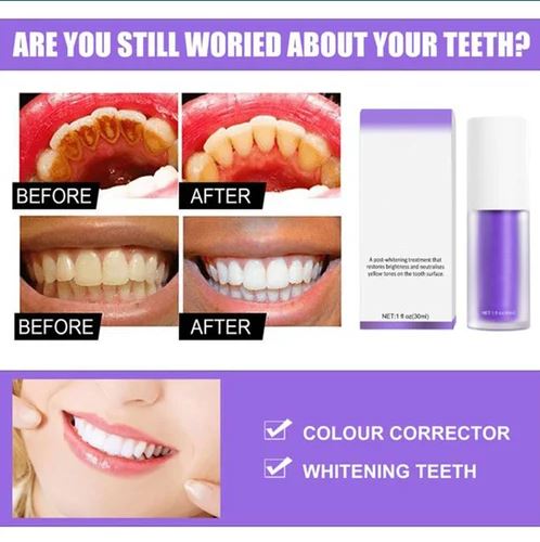 🔥LAST DAY 55% OFF🔥Teeth Colour Corrector Serum